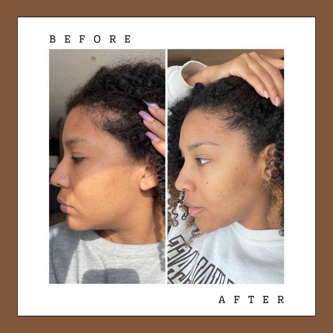 Scalp Elixir